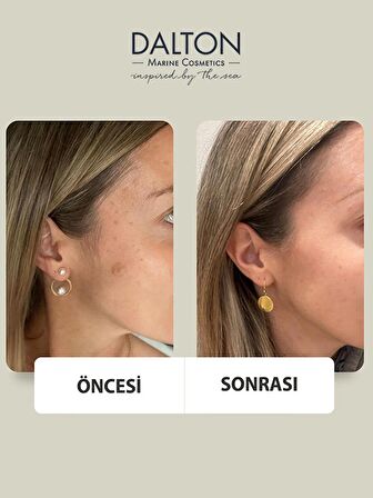 Tüm Cilt tipleri İçin gözenek Sıkılaştırıcı Niacinamide Serum