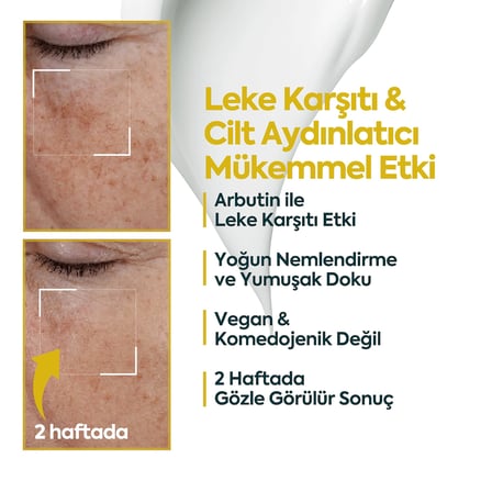 CLASYCARE Leke Karşıtı Aydınlatıcı