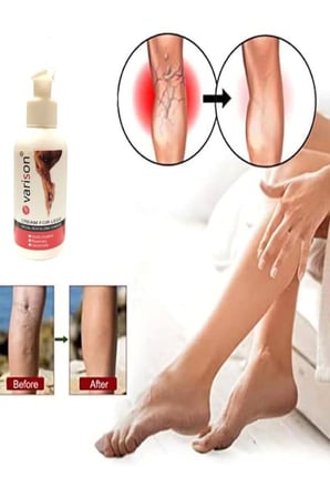 Trendexa On Sellülit Bacak Bakım Kremi 120 ml MAC
