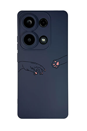 Xiaomi Redmi Note 13 Pro 4G Uyumlu Hand and Paw Desenli Premium Silikonlu Lansman Telefon Kılıfı