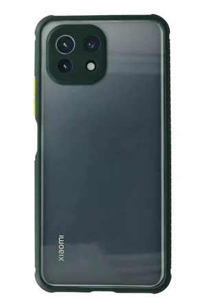 Newface Xiaomi Mİ 11 Lite Kılıf Miami Şeffaf Silikon - Koyu Yeşil
