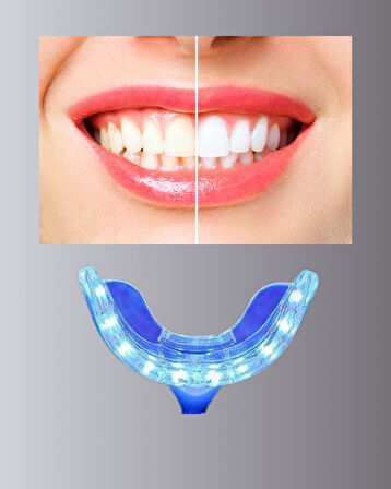 Beyazlatma Kalemli LED Diş Parlatma Seti