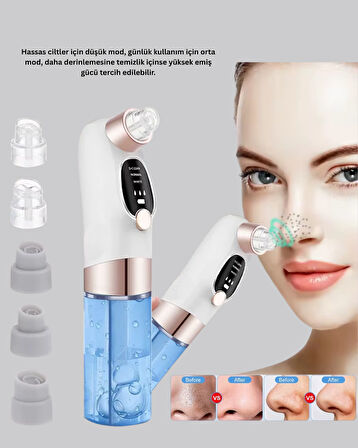 Vakum Teknolojili Siyah Nokta Temizleyici – Cilt Tonu Eşitleyen Masajlı Cilt Bak