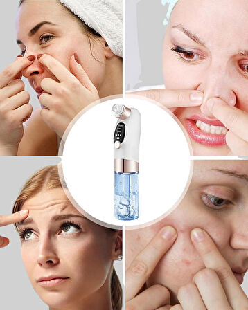 Evde Kolay Kullanım İçin Şarjlı Siyah Nokta Temizleme Aleti