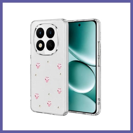 Bezos Redmi Note 15 Pro Plus 5G Uyumlu Fiyonk Desenli Kapak - Desen 3 NIDA