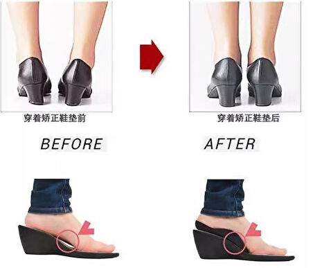 Esnek Düz Taban Düzeltici Topuk Yastığı