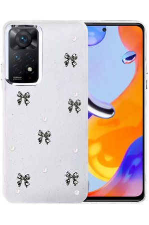 Sh Newface Xiaomi Redmi Note 11 Pro Fiyonk Desenli Kapak - Desen 8 Najmaddin