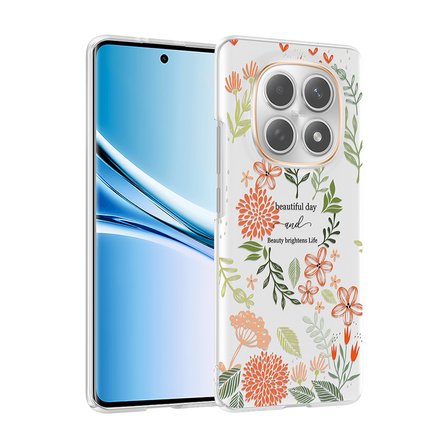 Xiaomi Redmi Note 14 Pro 4G Uyumlu Kılıf Desenli Kapak Zr-Klip