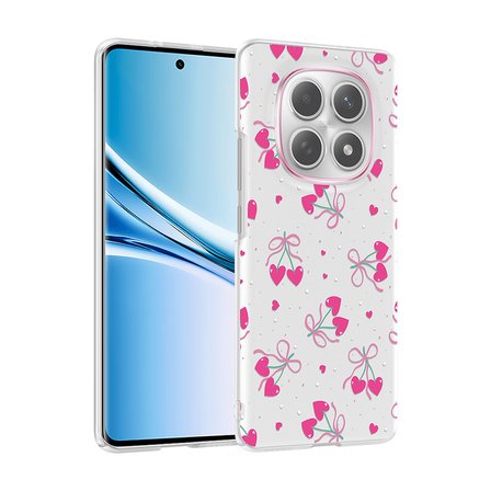 Xiaomi Redmi Note 14 Pro 4G Uyumlu Kılıf Desenli Kapak Zr-Klip