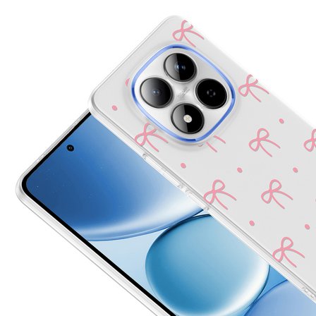 Xiaomi Redmi Note 15 Pro Plus Uyumlu Kılıf Desenli Kapak Zr-Klip