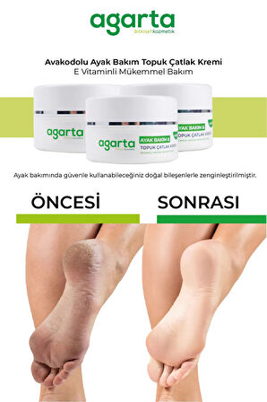 Agarta Ayak ve Topuk Çatlak Bakım Kremi 100ML (12 Li Set)