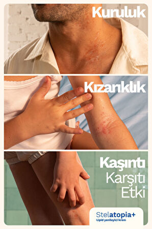 Mustela Stelatopia Lipit Yenileyici Krem Pompalı Şişe 300 ml 2 Adet