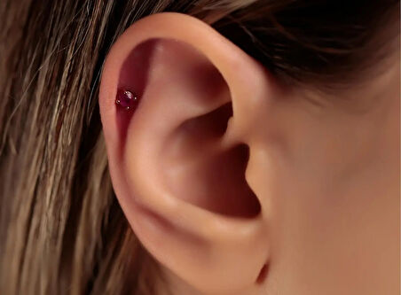 Radolite Piercing-Tragus