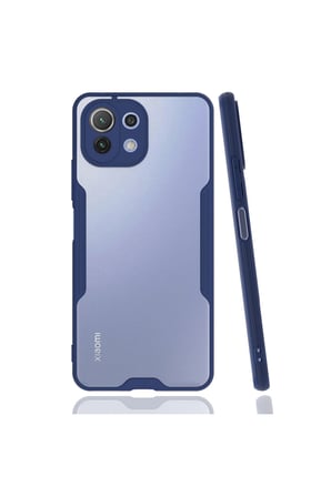 Mi 11 Lite Kılıf Platin Silikon - Lacivert