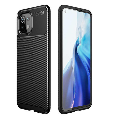 Xiaomi Mi 11 Lite Uyumlu Kılıf Ultra Slim Fit Karbon Silikon