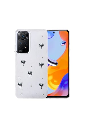 Redmi Note 11 Pro Fiyonk Desenli Kapak - Desen 1