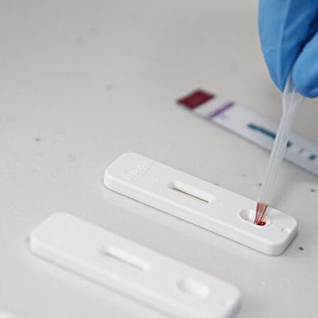 RASTMED - ABBOTT HIV-AIDS TESTİ EV TİPİ (RSTMD)