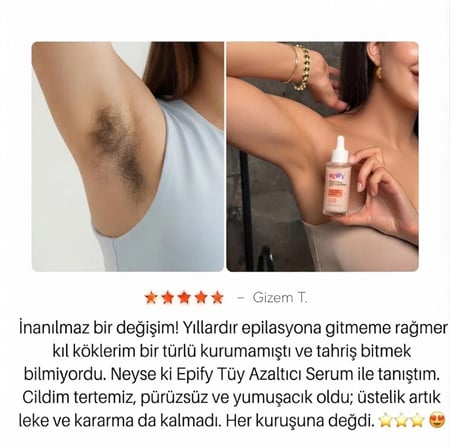 Epıfy Papaya Özlü Tüy Azaltıcı & Geciktirici Serum 75 ml - Çift Fazlı Pürüzsüzleştirici Cilt Bakım Serumu