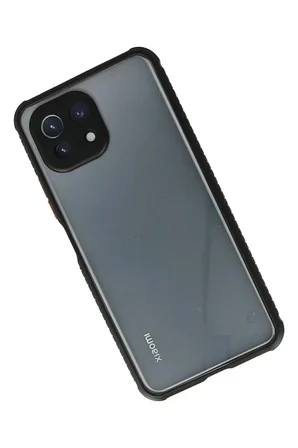 Newface Xiaomi Mİ 11 Lite Kılıf Miami Şeffaf Silikon - Siyah