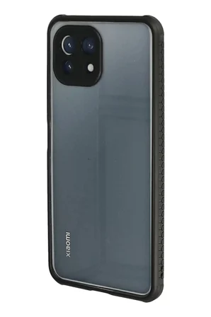 Newface Xiaomi Mİ 11 Lite Kılıf Miami Şeffaf Silikon - Siyah