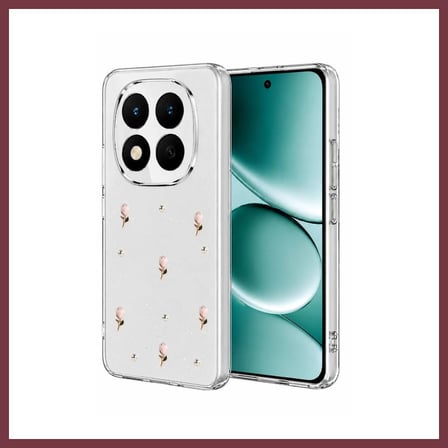 SHNSTORE Redmi Note 15 Pro Plus 5G Uyumlu Fiyonk Desenli Kapak - Desen 6 SHN0720