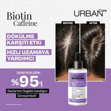 URBAN Care Expert Serisi Biotin ve Kafein Saç Toniği-Hızlı Uzamaya -200