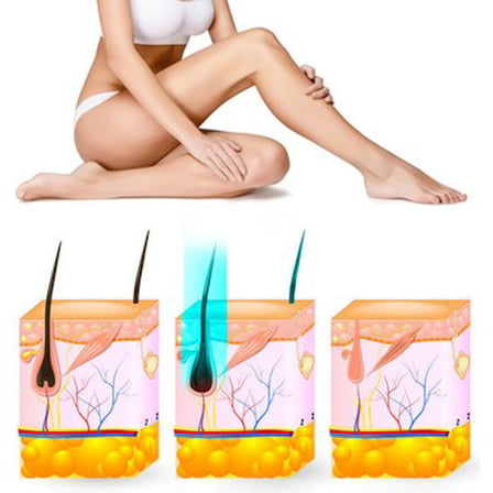 Yui IPLV15 Pro Vücut -Yüz- Bikini Başlıklı Ağrısız Otomatik ve Manuel Atım Buz Lazer Epilasyon