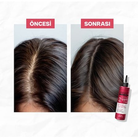 Elma Sirkesi Özlü Tonik 200 ml Saç Bakımı için