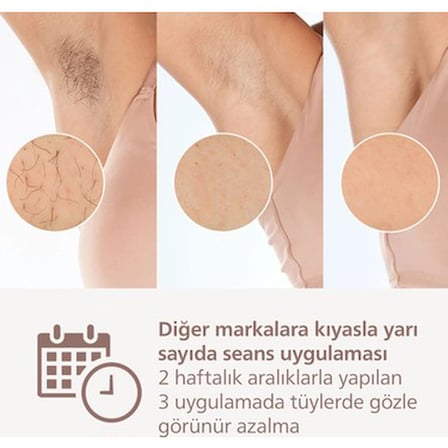 Philips Lumea 9900 Serisi BRI953/01 IPL Tüy Alma Beyaz Renk Özellikli Cilt Temas