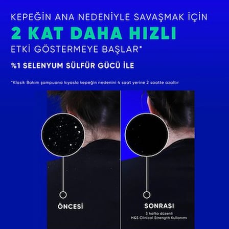 Head&Shoulders Head & Shoulders Clinical Strength Cooling Itch Rescue Kaşıntı Karşıtı Şampuan 400