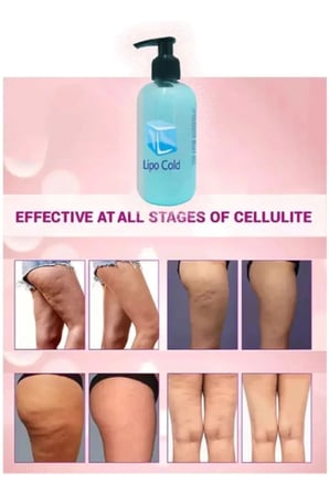 Lipo Cold Sıkılığa Inceliğe Hafifliğe Ve Selülilitlerinize Güçlü Etkide Krem 250 ml