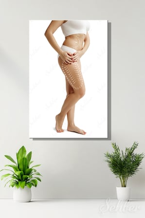 Dekoratif Dikey Kanvas Tablo Tekli Plastik Cerrahi Estetik Kliniği Güzellik Merkezi Liposuction 1294