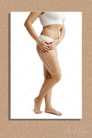 Dekoratif Dikey Kanvas Tablo Tekli Plastik Cerrahi Estetik Kliniği Güzellik Merkezi Liposuction 1294