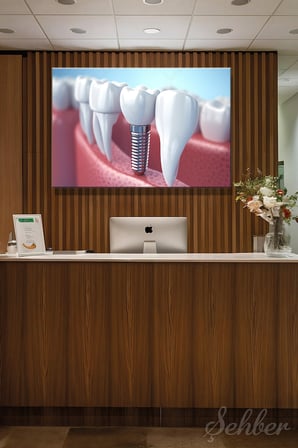 Dekoratif Yatay Kanvas Tablo Tekli  Ağız Diş Sağlığı Dişçi Poliklinik Hastane Dental İmplant 1446
