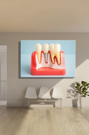 Yatay Kanvas Tablo Tekli Ağız Diş Sağlığı Dişçi Poliklinik Hastane Dental İmplant Simülasyonu 2949