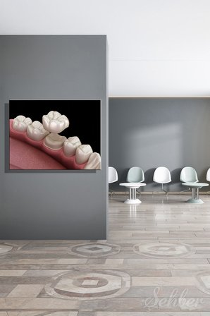 Kanvas Tablo Yatay Tekli  Ağız Diş Sağlığı Diş Tacı Dental Crown Sabit Protez Türü 2959