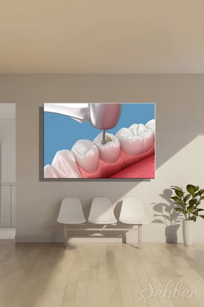 Yatay Kanvas Tablo Tekli Ağız Diş Sağlığı Çürük Temizleme Kök Kanal Tedavisi Hazırlığı 2960