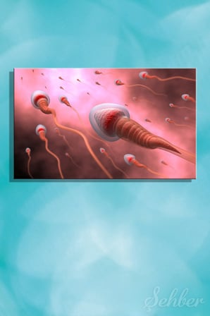 Sperm Hücrelerinin Yumurtaya Doğru Hareketi Tıbbi İllüstrasyon Kanvas Tablo Yatay Tekli 3366