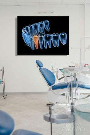 Premolor Dişin İmplant Tedavisi 3D Tıbbi Çizim Yatay Kanvas Tablo Tekli Ağız Diş Sağlığı 3480