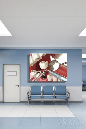 Yapay Diş Kökünün Çene Kemiğine Yerleştirilmesi 3D Modelleme Yatay Kanvas Tablo 4231