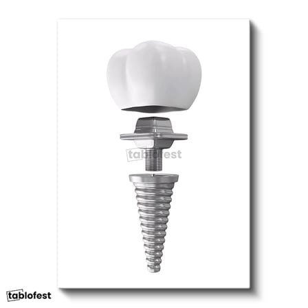 Dikey Kanvas Tablo Dental İmplant Parçaları Diş Hekimi Tablosu Ev Ofis Duvar Dekoru