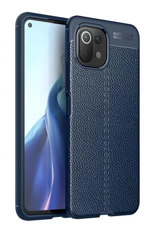 Newface Xiaomi Mİ 11 Lite Kılıf Auto Focus Kapak - Lacivert