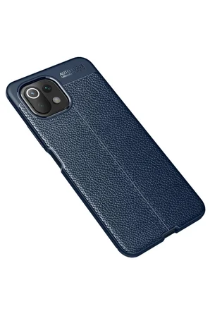 Newface Xiaomi Mİ 11 Lite Kılıf Auto Focus Kapak - Lacivert