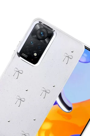 Newface Xiaomi Redmi Note 11 Pro Fiyonk Desenli Kapak - Desen 5