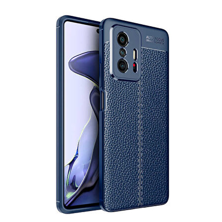 Xiaomi Mi 11T 5G Kılıf Deri Görünümlü Slim Silikon 