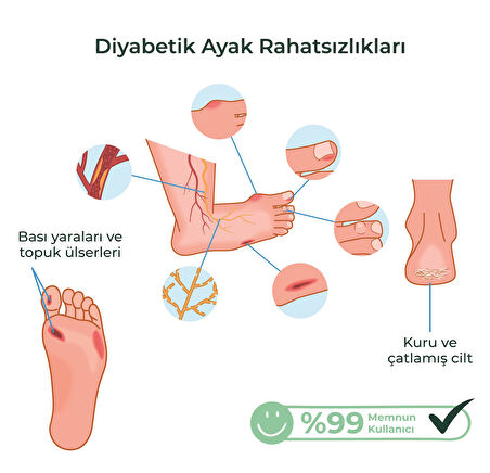 Med-Cover Ayak Bakım Kremi – Diyabet Uyumlu & Hassas Ciltlere Özel (%10 Üre, Shea Butter, Beeswax)