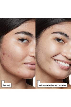 Cicapair™ Kaplan Otu İçeren Kızarıklık Karşıtı Renk Eşitleyici Bakım Serumu SPF35 30ML