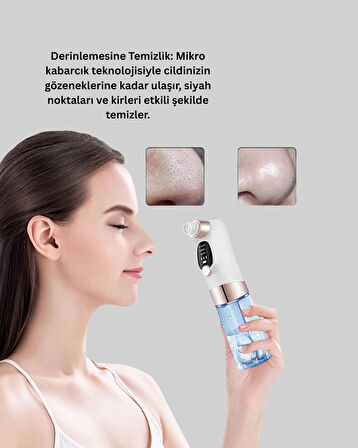 Titreşimli Elektrikli Gözenek Açıcı – Siyah Nokta ve Yağ Arındırıcı