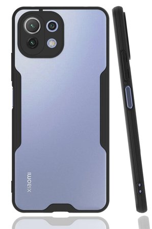 Uray store Xiaomi Mİ 11 Lite Kılıf Platin Silikon - Siyah