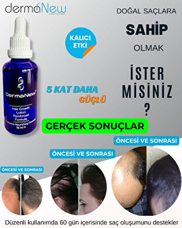 Saç Losyonu Saç Bakım Yağı - saç gürleştirici - saç yağı lotion / 3 Adet Serum+ Şampuan + Roller